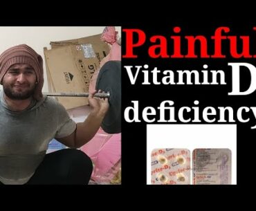 Painful vitamin D3 deficiency | vitamin D3 in depth by Shravan jr