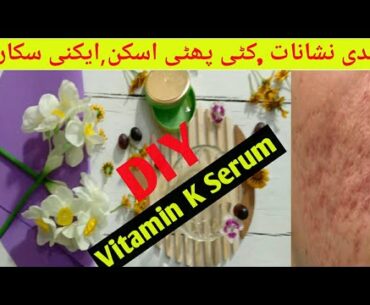 How To Remove Dark Spots From Face Naturally /DIY Vitamin K Serum!!