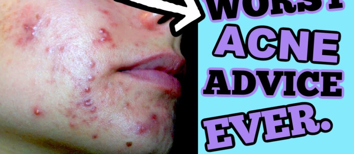 TOP WORST SKINCARE ADVICE I HAVE EVER RECEIVED! || SO YOU DON'T HAVE TO LEARN THE HARD WAY..