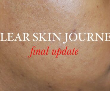 CLEAR SKIN JOURNEY I VITAMINS FOR 30 DAYS FOR CLEAR SKIN I WEEK 3 & 4 UPDATE (WITH PICTURES)