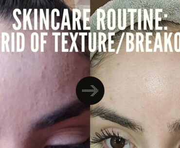 HOW TO GET RID OF TEXTURED SKIN / MILD ACNE / FUNGAL ACNE / REGULATE HORMONAL BREAKOUTS / B3 & B5