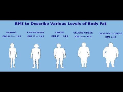 Obesity link to Vitamin D deficiency