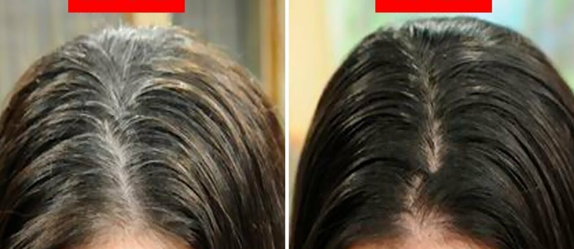 Home Remedies to Turn White Hair Black Without Chemical Dyes