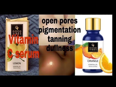 #skincare #beauty Vitamin C serum face brightness whitening ( pigmentation ke problem ke liye serum)