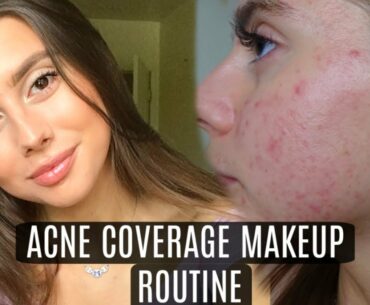 BEST EVERYDAY ACNE COVERAGE MAKEUP || Chit Chat GRWM feeling behind and being unmotivated!!