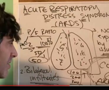 COVID19:  As requested - ARDS explained for the general public!