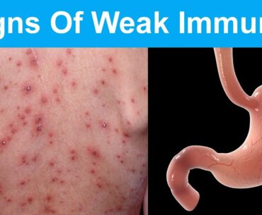 10 Warning Signs Of Weak Immunity You shouldn't Ignore