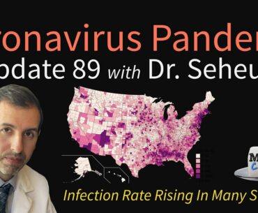 Coronavirus Pandemic Update 89: COVID 19 Infections Rising in Many States; Dexamethasone Cautions