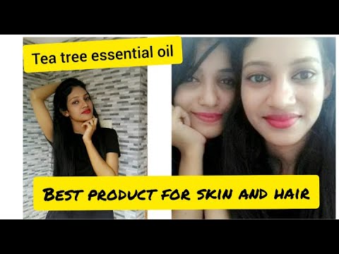 Tea tree essential oil review | for both boys and girls | affordable product for skin and hair |