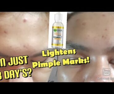 Pampaalis ng Dark Spots at Pimple Marks!/Garnier Vitamin C Serum Honest Review/Raquel Pinca