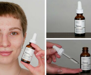 How To Use The Ordinary Ascorbyl Tetraisopalmitate Solution 20% in Vitamin F