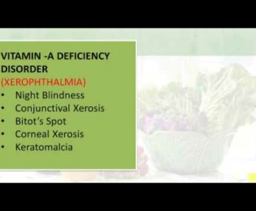 Vitamin-A Deficiency Disorder - Ms B Thanuja