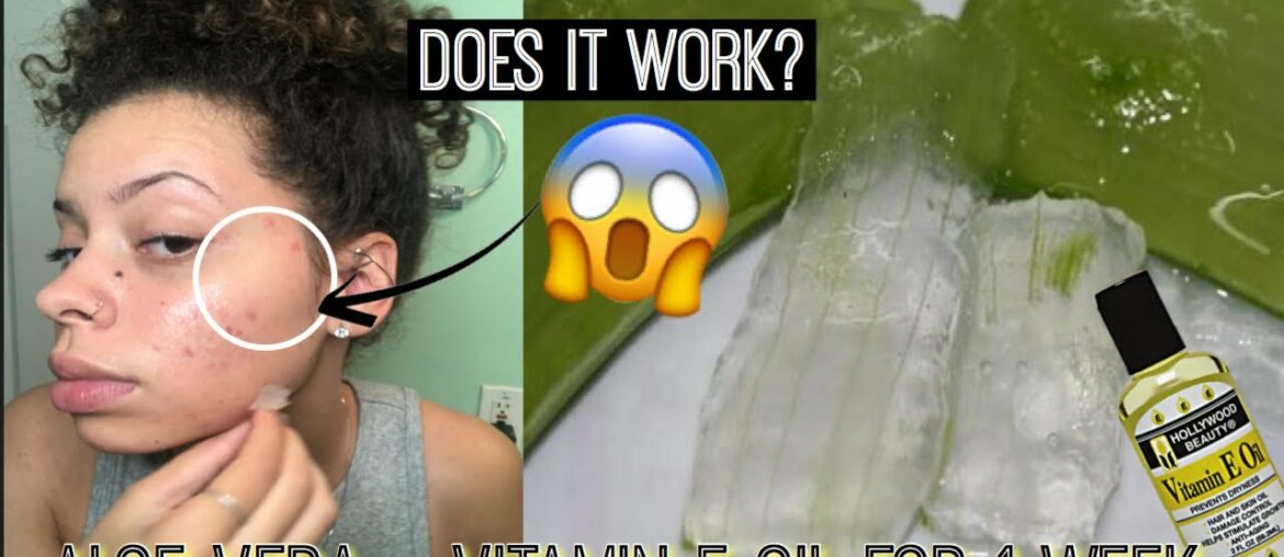 I Used Fresh Aloe Vera + Vitamin E Oil On My Face For 1 Week & This Happened