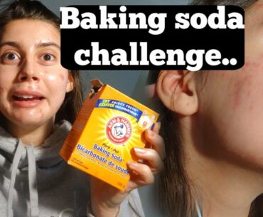 ACNE IS CAUSED BY LOW STOMACH ACID!? || BAKING SODA CHALLENGE TEST FOR MY STOMACH ACIDS..