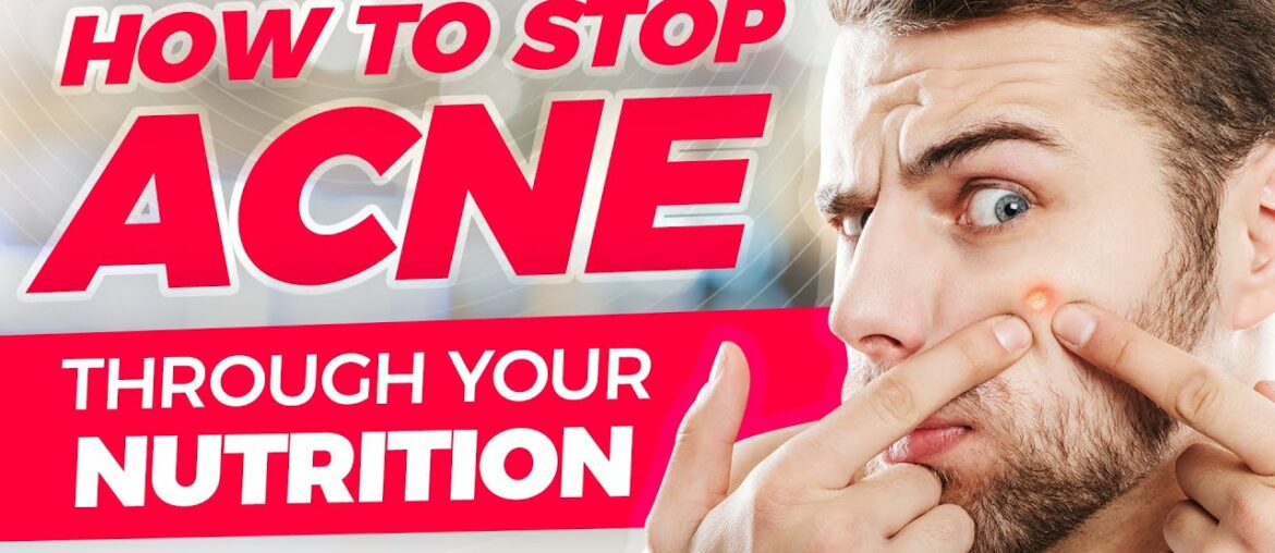How to Stop Acne Through Nutrition