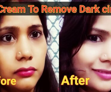 How To Remove Dark Circle/DIY Cream For Remove Dark Circle/Vitamin E/Alovera/potato.