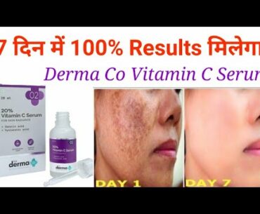 The Derma Co 20% Vitamin C Serum | skin whitening, pigmentation, dark spot, sun tan, skin damage|