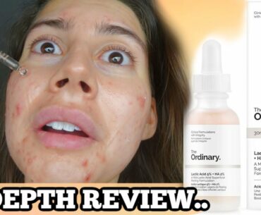 I TESTED THE ORDINARY LACTIC ACID FOR MY ACNE SCARS FOR 3 WEEKS.. THIS IS WHAT HAPPENED.