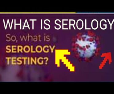 SEROLOGY: Testing Covid-19 antibodies to determine immunity.