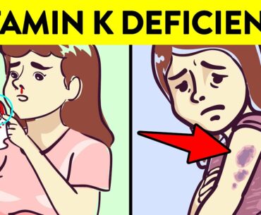 12 Hidden Signs You Have Vitamin K Deficiency