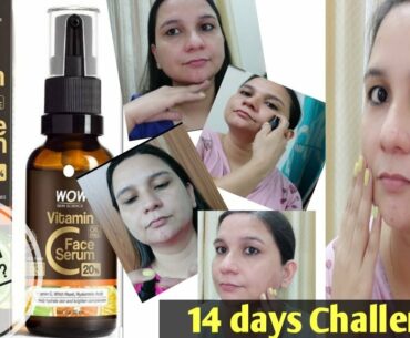 * NEW* WOW Skin Science 20% Vitamin C Face Serum ll 14 Days Challenge ll Review ll
