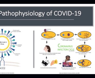 #COVID19 and Why Herd Immunity, Antibody and Rapid Tests Kits Are Not Reliable - Dr Peter Imoesi.