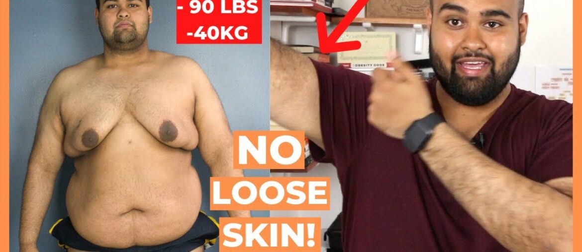 HOW TO AVOID LOOSE SKIN DURING WEIGHT LOSS with the right supplements!