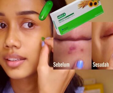 Skincare Routine Pakai Natur-E (bisa mengurangi bekas jerawat dan bekas luka) | Skincare Murah