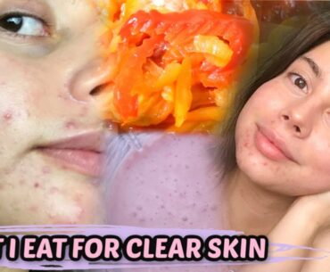 WHAT I EAT IN A DAY TO CLEAR MY ACNE, OPTIMAL GUT HEALTH || SUPPLEMENTS, DIET, EVERYTHING!!