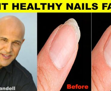 Top 10 Vitamins For Strong Healthy Nails - Dr Alan Mandell, DC