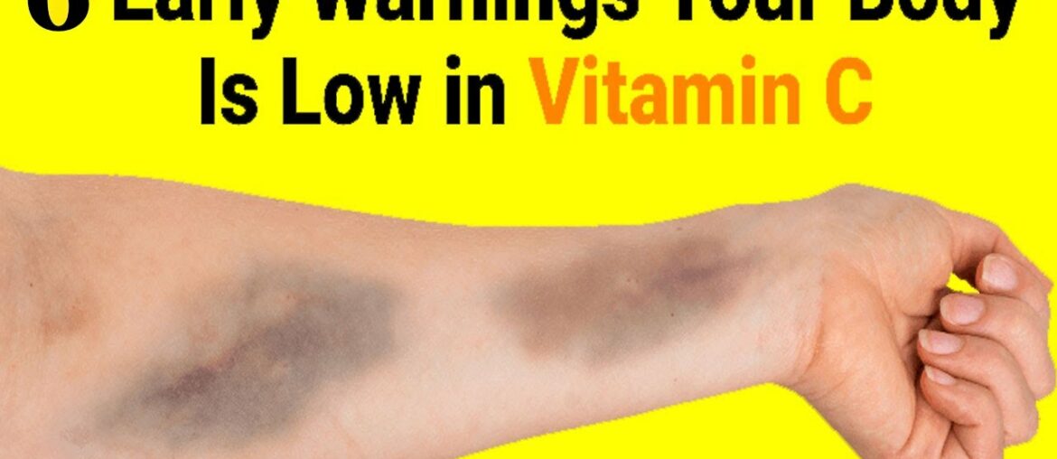 7 Early Warnings Your Body Is Low in Vitamin C