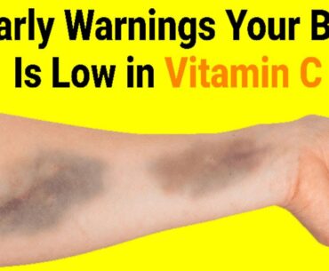 7 Early Warnings Your Body Is Low in Vitamin C