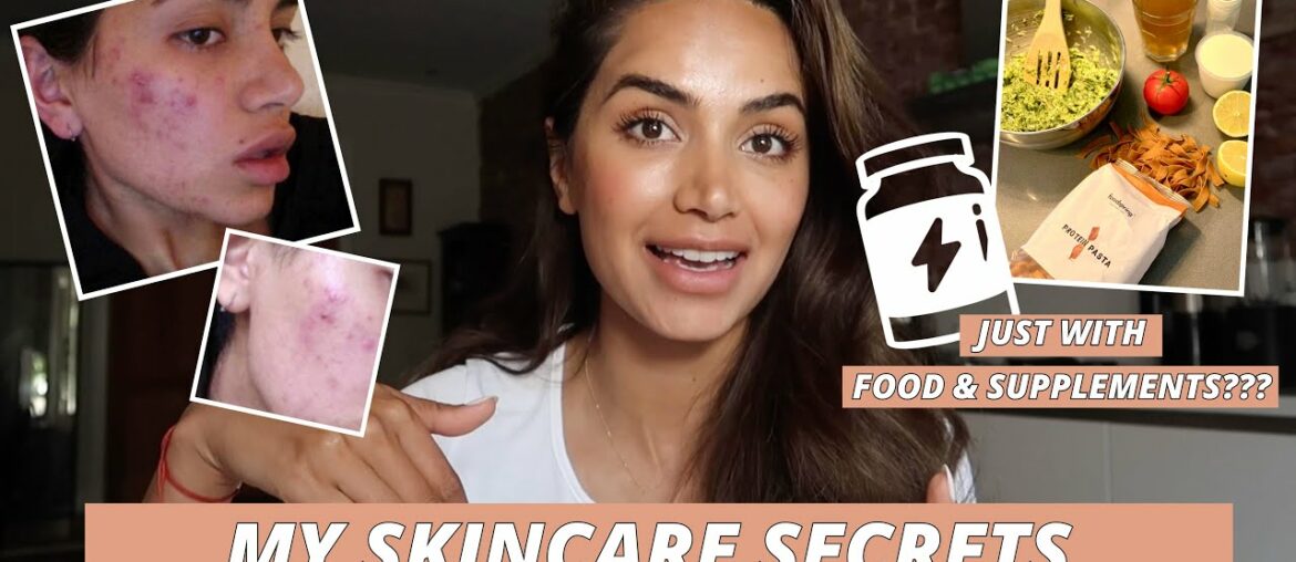 HOW I HEALED MY SKIN WITH FOOD AND SUPPLEMENTS // MY SKINCARE JOURNEY PART 3