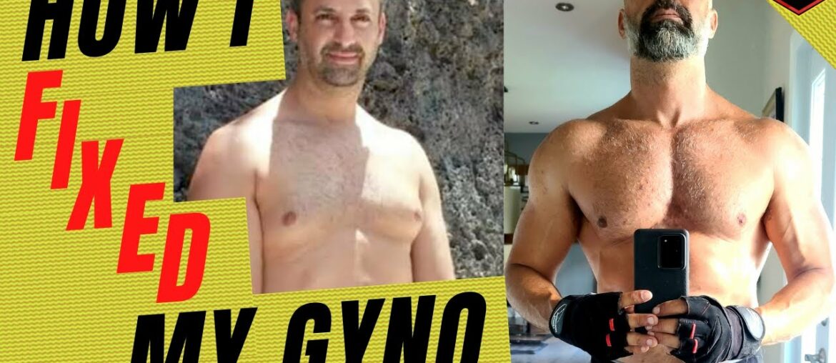 How I Fixed My Gynecomastia: How To Get Rid Of It With TRT (by Danny Bossa TRT)