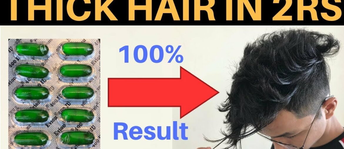 How To Get THICK & HEALTHY Hair | Vitamin E Hair Treatment | Evion 400 |