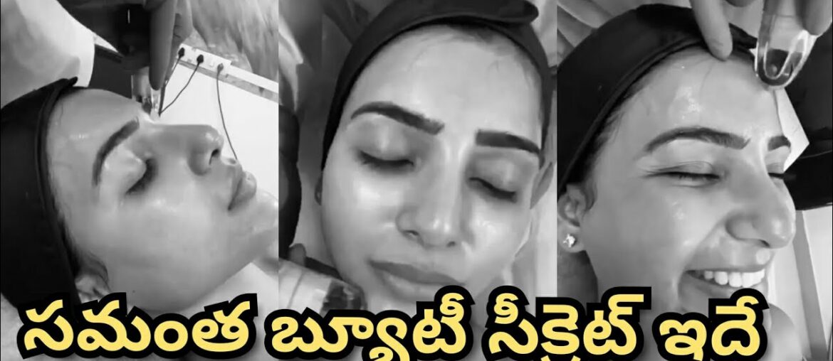 Samantha Glowing Skin Beauty Secret Revealed | Vitamin Infusion Treatment | Samantha Facial | HR Net