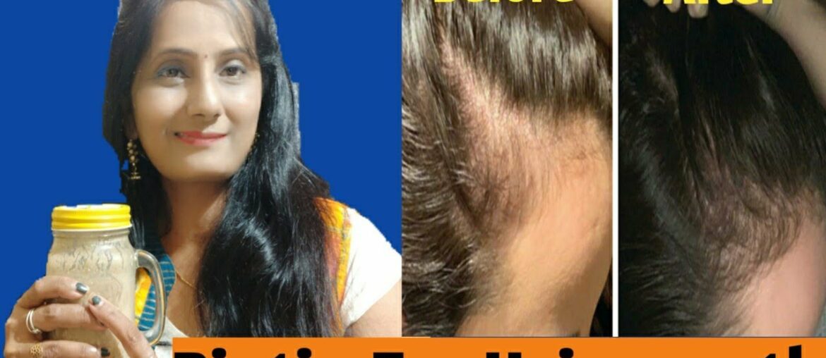 want to grow hair long fast|biotin supplement 4 hair biotin 4 hair growth in hindi|Aurobeautycar2020