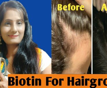 want to grow hair long fast|biotin supplement 4 hair biotin 4 hair growth in hindi|Aurobeautycar2020