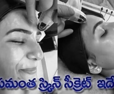 Actress Samantha Reveals Her Glowing Skin Secret | Vitamin Infusion Therapy | IG Telugu