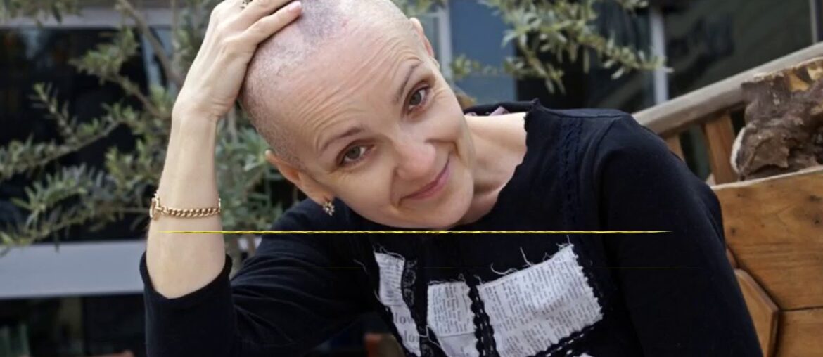 The Definitive Guide to Hair Loss or Alopecia - Cancer.Net