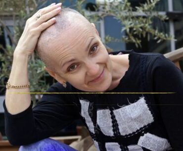The Definitive Guide to Hair Loss or Alopecia - Cancer.Net