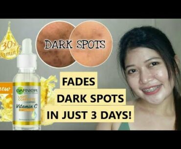 Garnier Vitamin C Serum Review | How to fade  dark spots | Garnier PH