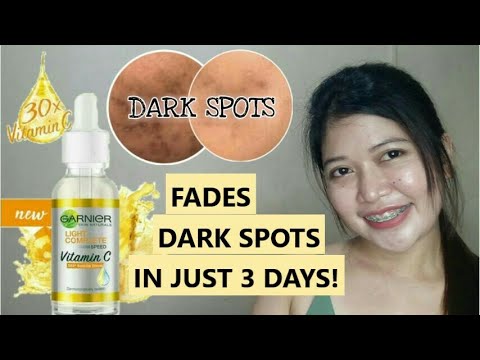 Garnier Vitamin C Serum Review | How to fade  dark spots | Garnier PH