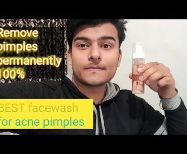 Saslic foaming facewash review | cipla saslic facewash for acne prone skin|