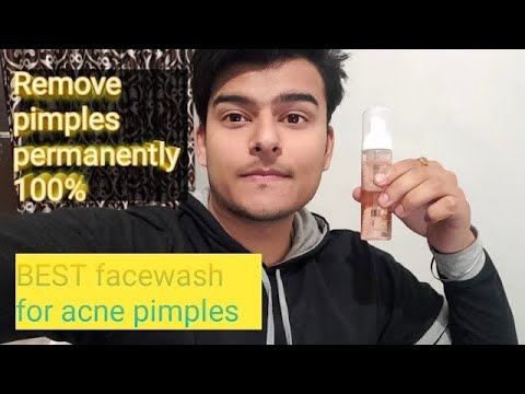 Saslic foaming facewash review | cipla saslic facewash for acne prone skin|