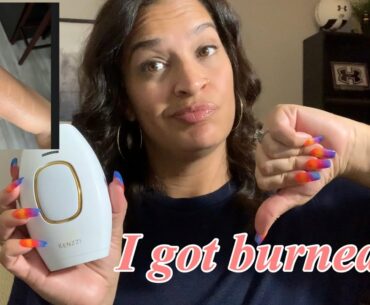 My Kenzzi burned my arms | my scars | Vitamin E oil | I got burned | Kenzzi review | Kenzzi update