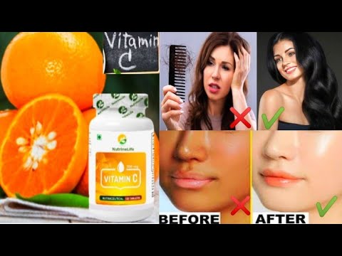 Nutrinelife Vitamin C Supplement Tablets | Benefits of Vitamin C | Nutrinelife vitamin c |#vitaminc