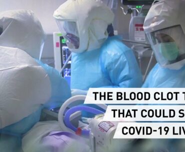 The blood clot test that could save #COVID19 patients #testing