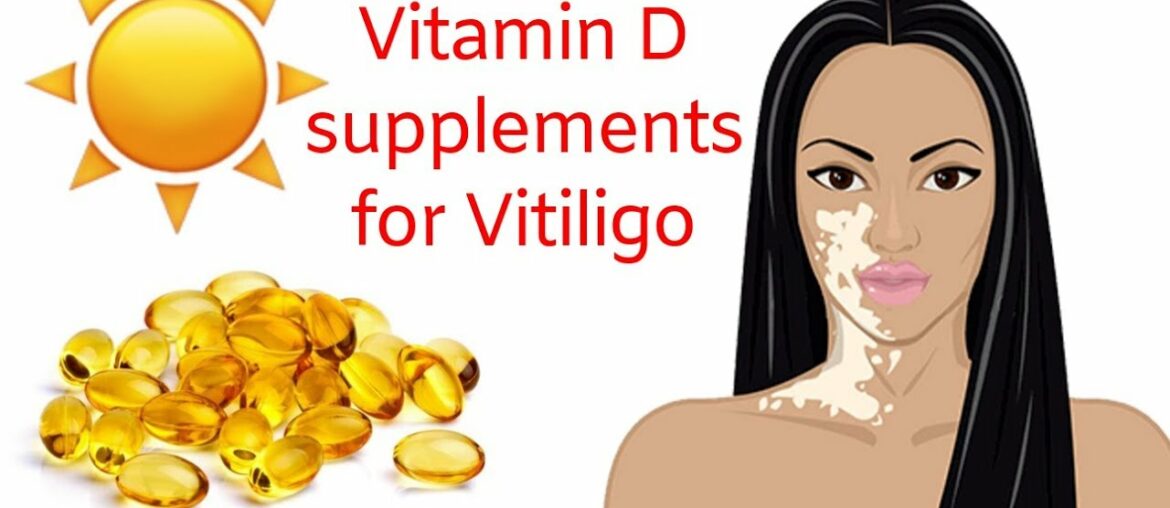 Vitamin D supplements for Vitiligo healing