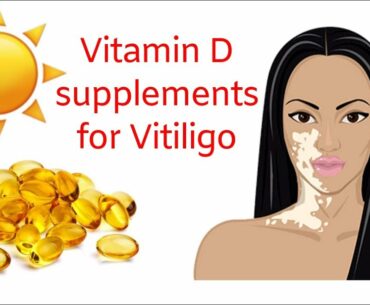 Vitamin D supplements for Vitiligo healing